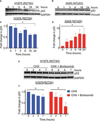 Proteasome inhibition paradoxically degrades gain-of-function mutant p53 R273H in NSCLC and could have therapeutic implications